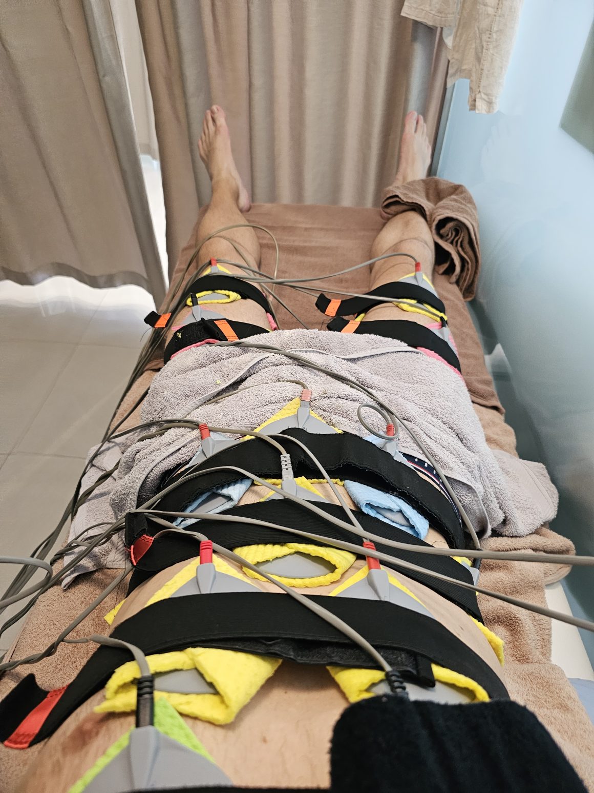 My EMS treatment setup, with electrodes secured around different muscle groups using Velcro straps.