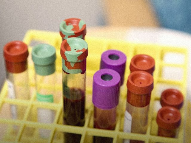 Blood sample tubes in a yellow lab rack, Canyon Ranch LONGEVITY8 review