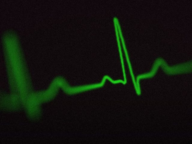 Green heartbeat line on a black screen, health metrics worth tracking