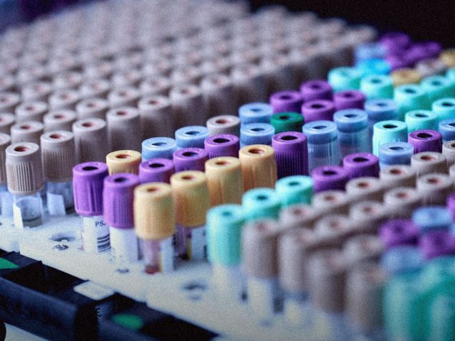Rack of blood collection tubes with coloured caps, longevity clinic tests